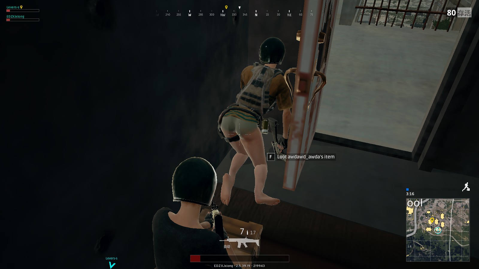 他在伤病缠 他在伤病缠